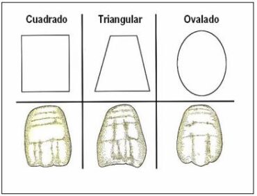 ¿Qué dientes elegimos?