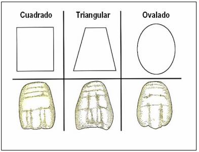 ¿Qué dientes elegimos?